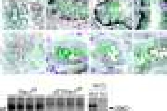 研究发现蛋白质Rac1在受损肾脏修复中发挥双重作用