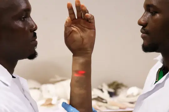 “假肢不是为我们这样的人制造的”：尼日利亚两兄弟研发面向非洲用户的逼真假肢