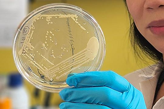 研究锁定肠道细菌或为“自身酿酒综合症”治疗提供新思路