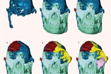 科学家数字重建距今367万年“幼足”南方古猿面部