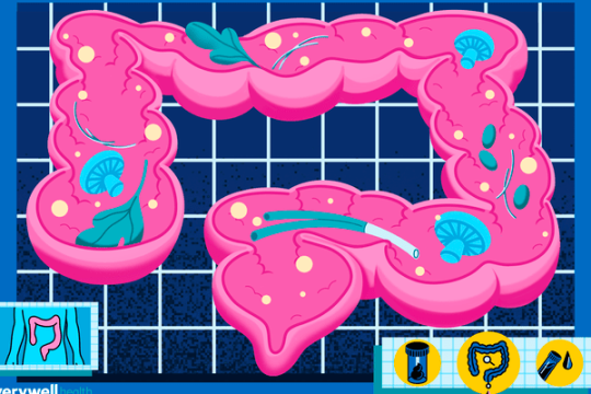 结肠癌预防的新进展