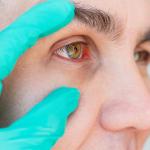 新型糖尿病黄斑水肿治疗将眼部注射次数从每月减少到每年两次