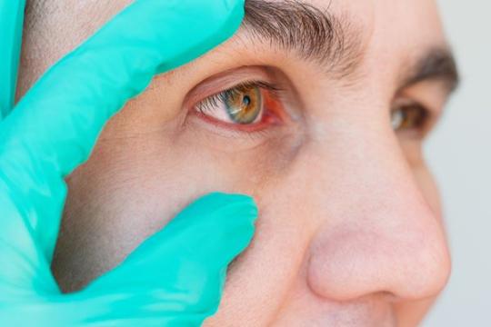 新型糖尿病黄斑水肿治疗将眼部注射次数从每月减少到每年两次