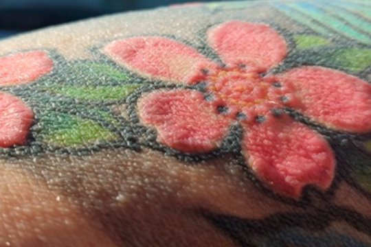 波兰男子纹身后出现全身脱发及无汗罕见并发症 研究呼吁加强墨水监管