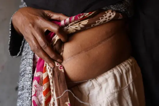 “全国都在做”：非法肾脏交易如何盯上巴基斯坦绝望的砖窑工人