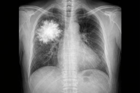 研究发现多模态AI会为“看不见”的图像编造细节